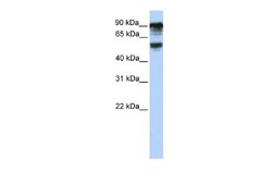 TBC1D10B Rabbit anti-Human, Polyclonal, Novus Biologicals 0.1 mL | Buy Online | Novus Biologicals | Fisher Scientific